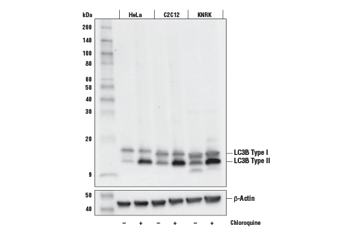 Western Blotting Image 2: LC3B (E5Q2K) Mouse Monoclonal Antibody (BSA and Azide Free)