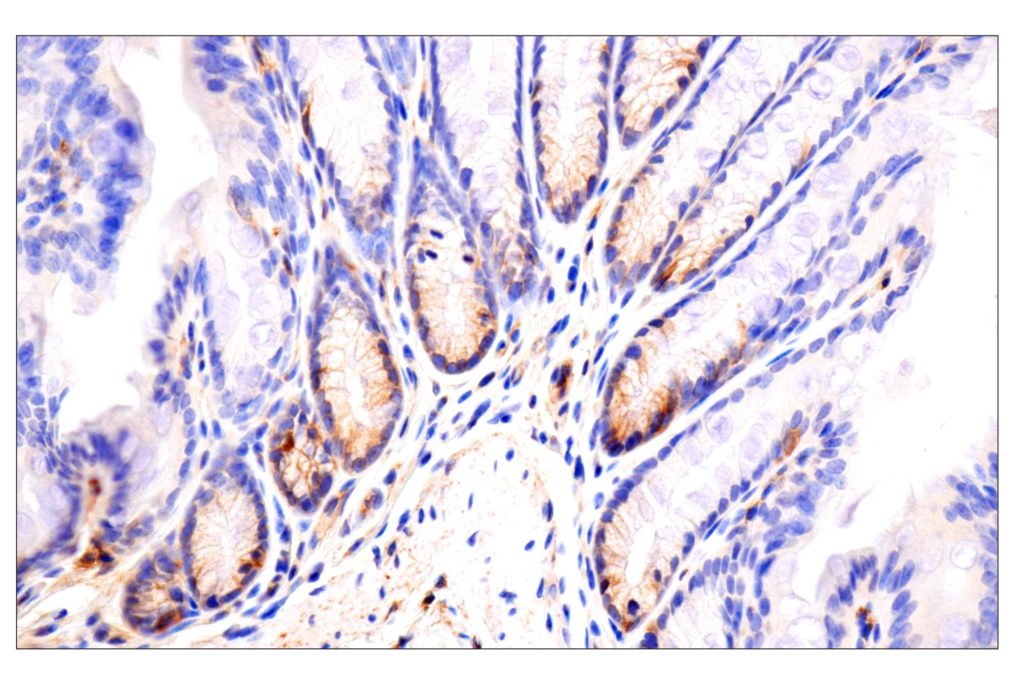 Immunohistochemistry Image 7: CD81 (D5O2Q) Rabbit mAb