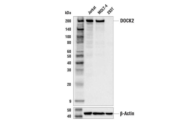Western Blotting Image 1: DOCK2 Antibody