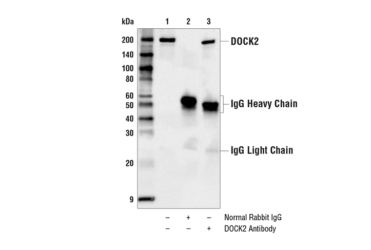 Immunoprecipitation Image 1: DOCK2 Antibody