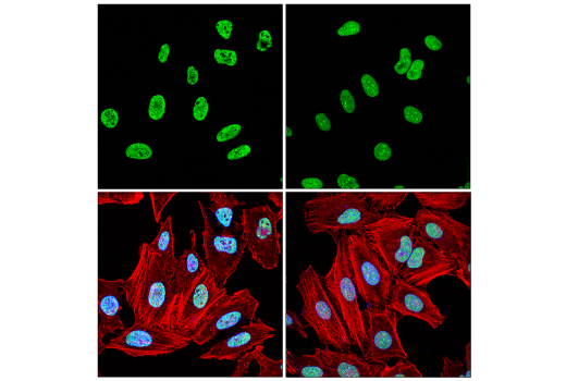 Immunofluorescence Image 3: NONO (E8Q3E) Rabbit mAb