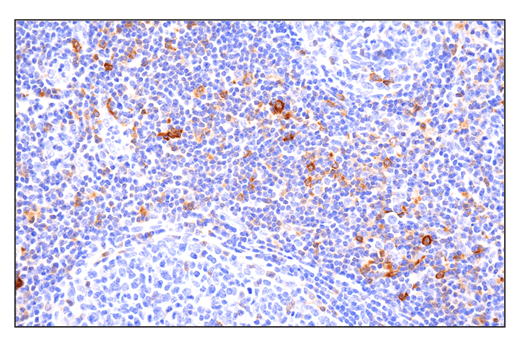 Immunohistochemistry Image 6: Phospho-SLP-76 (Ser376) (E3G9U) XP® Rabbit mAb (BSA and Azide Free)