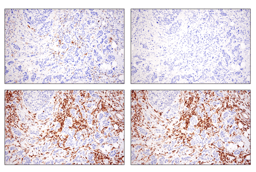 Immunohistochemistry Image 7: Phospho-SLP-76 (Ser376) (E3G9U) XP® Rabbit mAb (BSA and Azide Free)