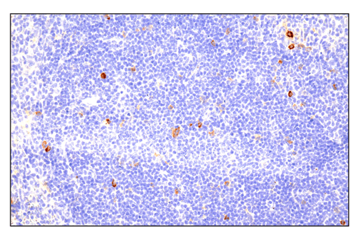 Immunohistochemistry Image 1: Phospho-SLP-76 (Ser376) (E3G9U) XP® Rabbit mAb (BSA and Azide Free)