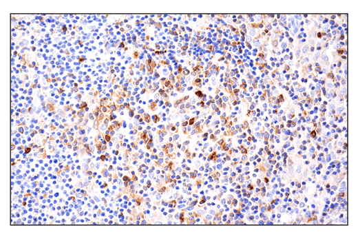 Immunohistochemistry Image 10: Phospho-SLP-76 (Ser376) (E3G9U) XP® Rabbit mAb (BSA and Azide Free)