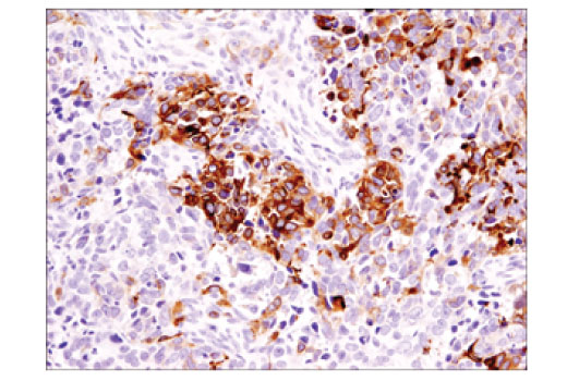 Immunohistochemistry Image 3: DCLK1/DCAMKL1 (D2U3L) XP® Rabbit mAb (BSA and Azide Free)