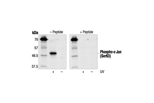  Image 1: Phospho-c-Jun (Ser63) II Blocking Peptide