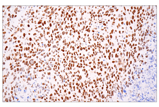 Immunohistochemistry Image 4: ATRX (E5X7O) Rabbit mAb