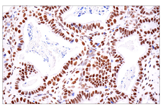 Immunohistochemistry Image 5: ATRX (E5X7O) Rabbit mAb
