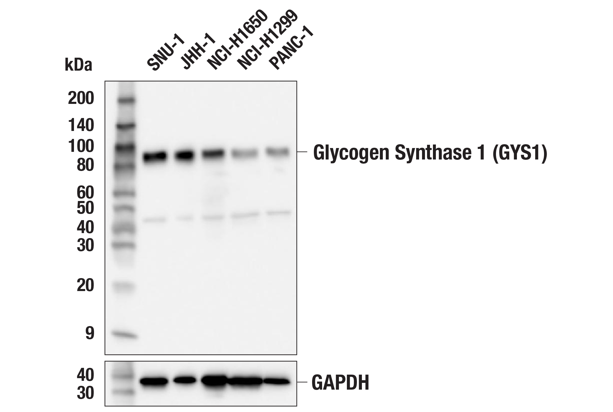 Western Blotting Image 2: Glycogen Synthase 1 (GYS1) (F4L8X) Rabbit mAb