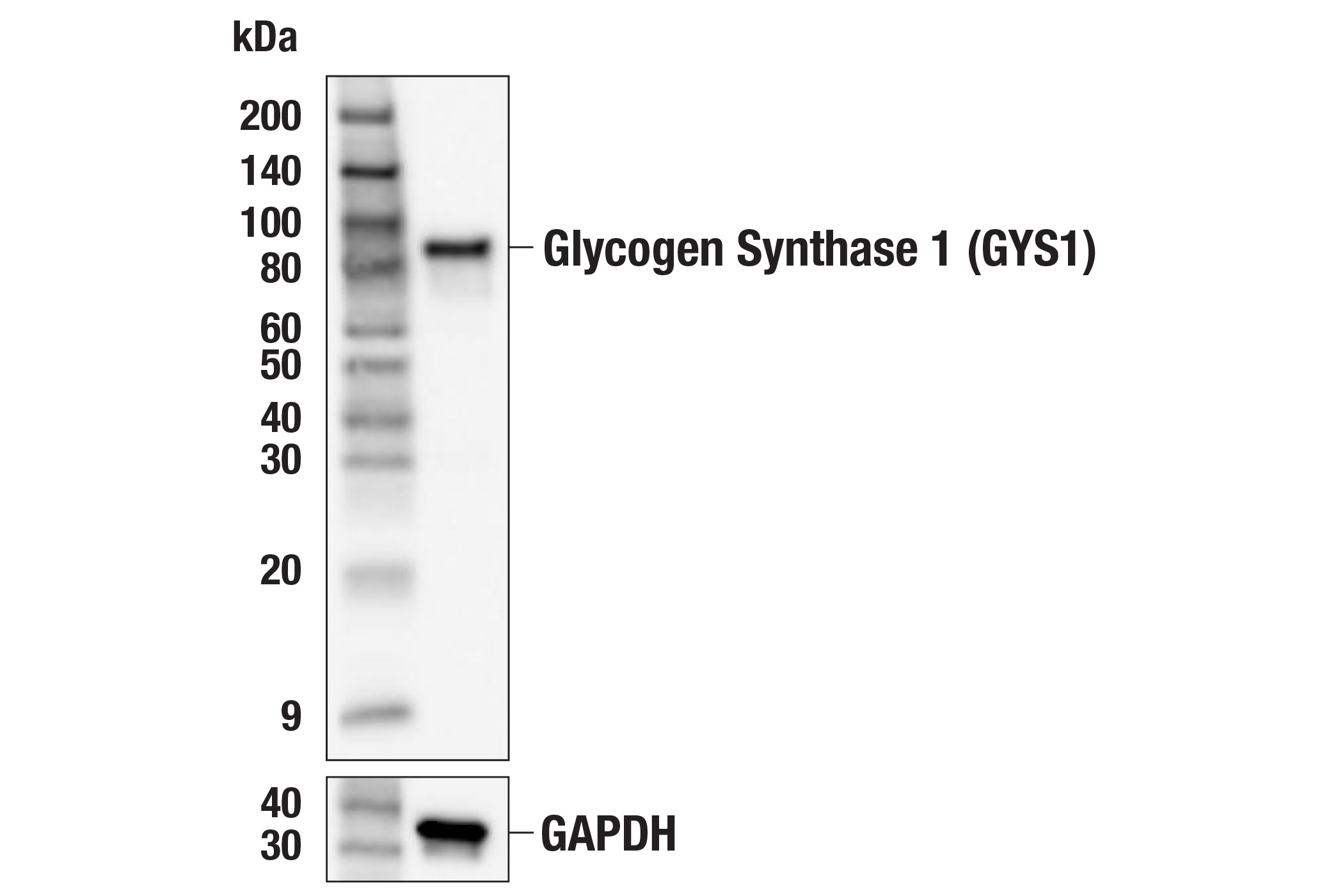 Western Blotting Image 1: Glycogen Synthase 1 (GYS1) (F4L8X) Rabbit mAb