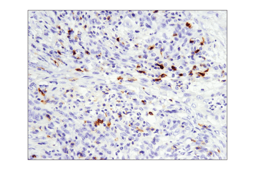 Immunohistochemistry Image 1: GITR (D5V7P) Rabbit mAb