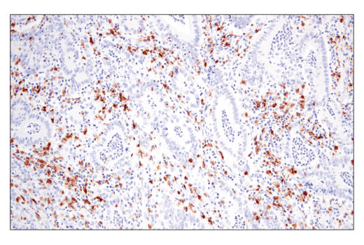 Immunohistochemistry Image 3: GITR (D5V7P) Rabbit mAb (BSA and Azide Free)