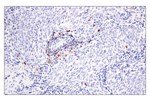 Immunohistochemistry Image 4: GITR (D5V7P) Rabbit mAb