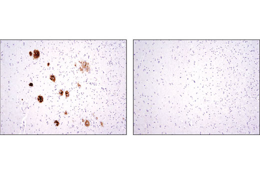 Immunohistochemistry Image 1: β-Amyloid (D12B2) Rabbit mAb (BSA and Azide Free)