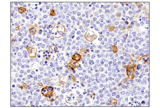 Immunohistochemistry Image 1: Kindlin-3 (D8I7V) Rabbit mAb