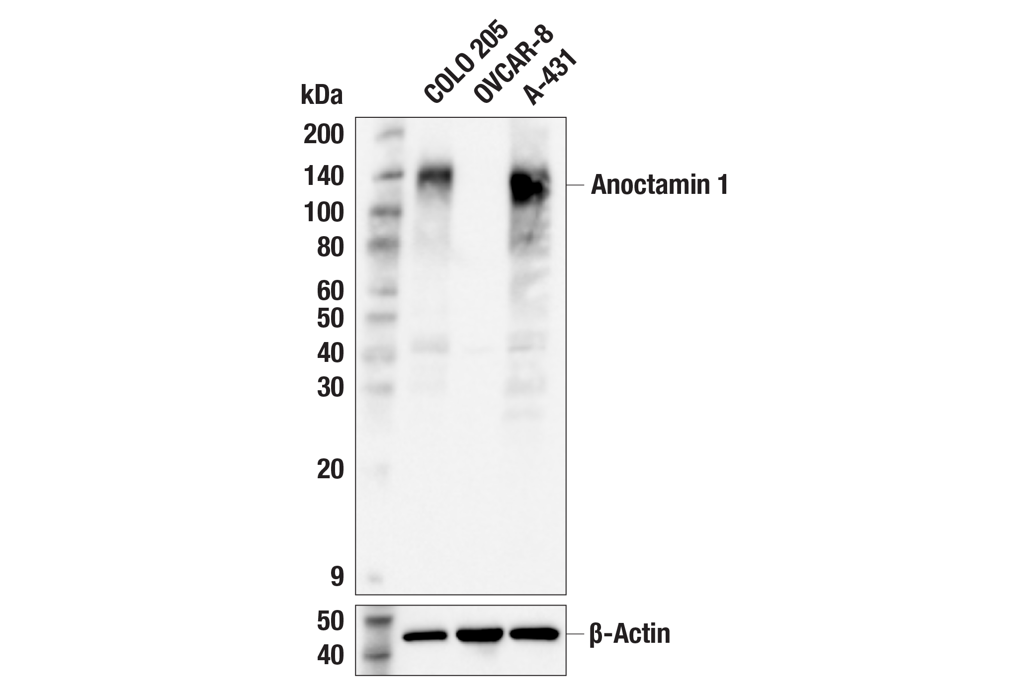 Western Blotting Image 2: DOG1/Anoctamin 1 (F9W4N) Rabbit mAb