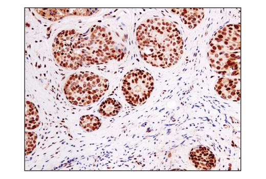 Immunohistochemistry Image 2: Ape1 (E5Y2C) Rabbit mAb