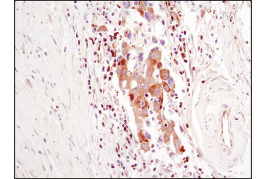 Immunohistochemistry Image 1: PLCγ1 (D9H10) XP® Rabbit mAb (BSA and Azide Free)