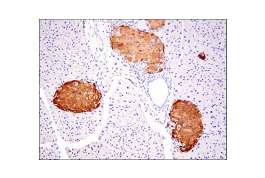 Immunohistochemistry Image 2: PLCγ1 (D9H10) XP® Rabbit mAb (BSA and Azide Free)