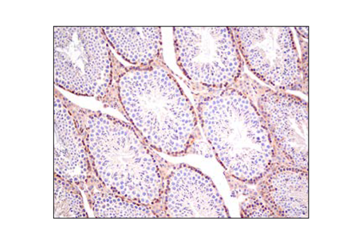 Immunohistochemistry Image 4: PLCγ1 (D9H10) XP® Rabbit mAb (BSA and Azide Free)