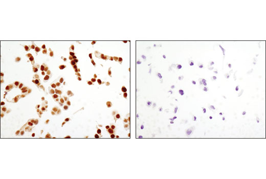 Immunohistochemistry Image 2: GATA-3 (D13C9) XP® Rabbit mAb (BSA and Azide Free)