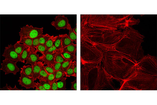 Immunofluorescence Image 1: GATA-3 (D13C9) XP® Rabbit mAb (BSA and Azide Free)
