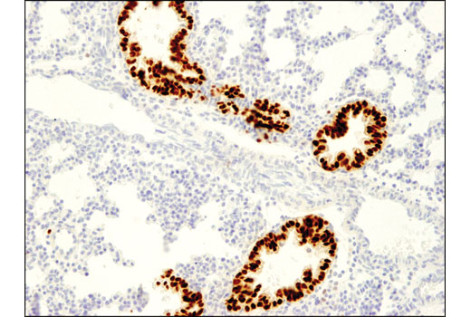 Immunohistochemistry Image 1: Sox2 (D1C7J) XP® Rabbit mAb (BSA and Azide Free)