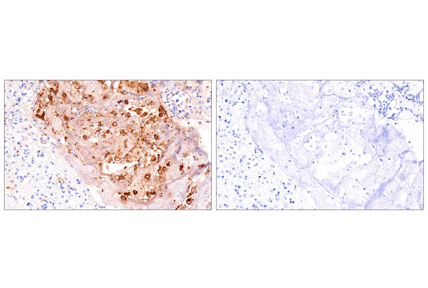 Immunohistochemistry Image 2: IL-8 (E5F5Q) XP® Rabbit mAb (BSA and Azide Free)