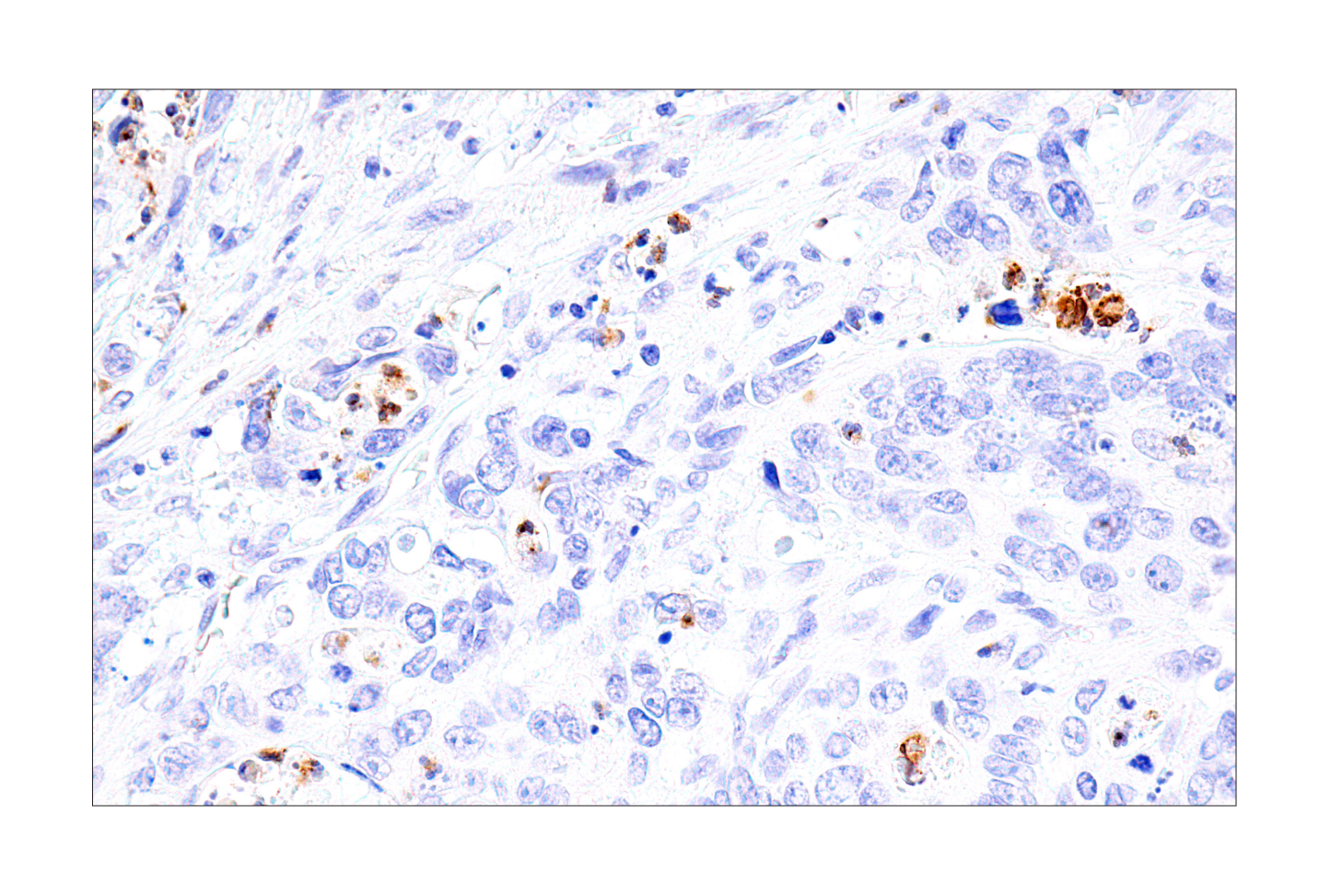 Immunohistochemistry Image 8: IL-8 (E5F5Q) XP® Rabbit mAb (BSA and Azide Free)