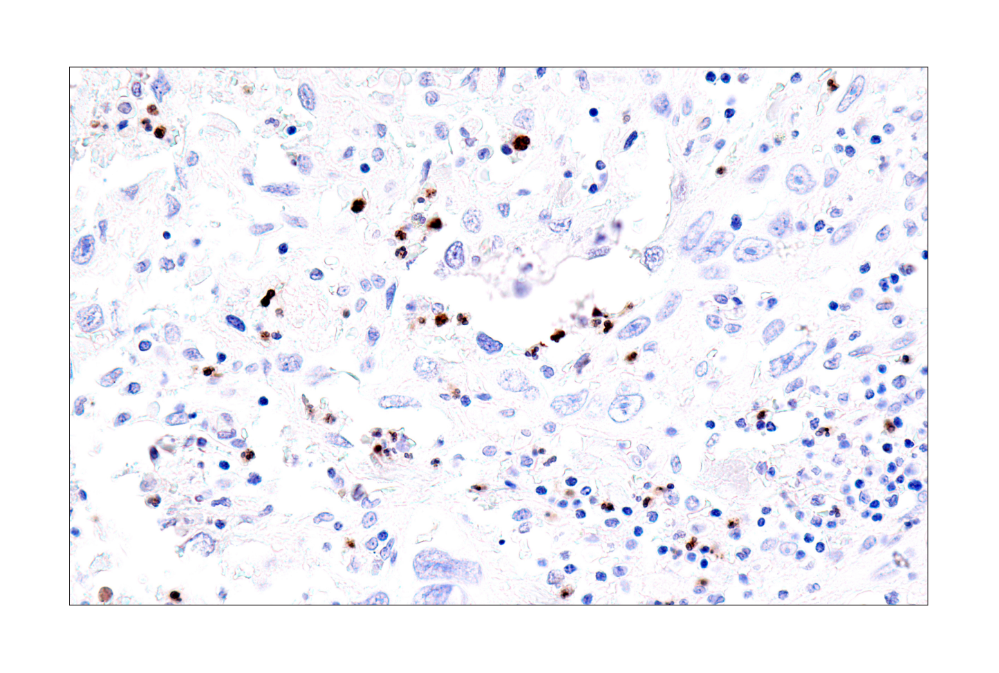 Immunohistochemistry Image 6: IL-8 (E5F5Q) XP® Rabbit mAb (BSA and Azide Free)