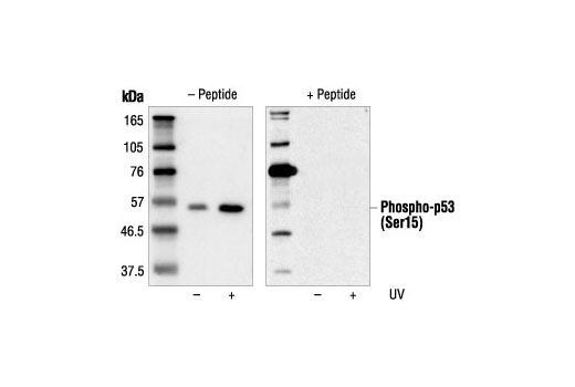  Image 1: Phospho-p53 (Ser15) Blocking Peptide