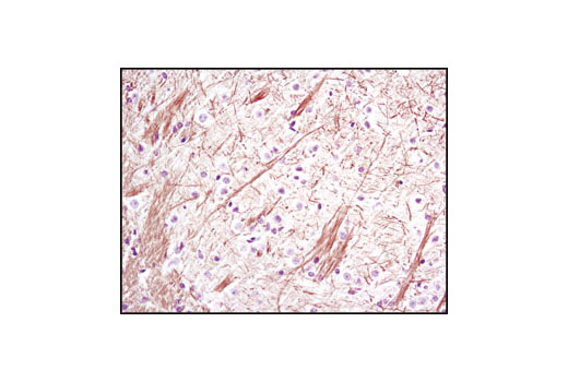 Immunohistochemistry Image 2: Neurofilament-L (C28E10) Rabbit mAb (BSA and Azide Free)