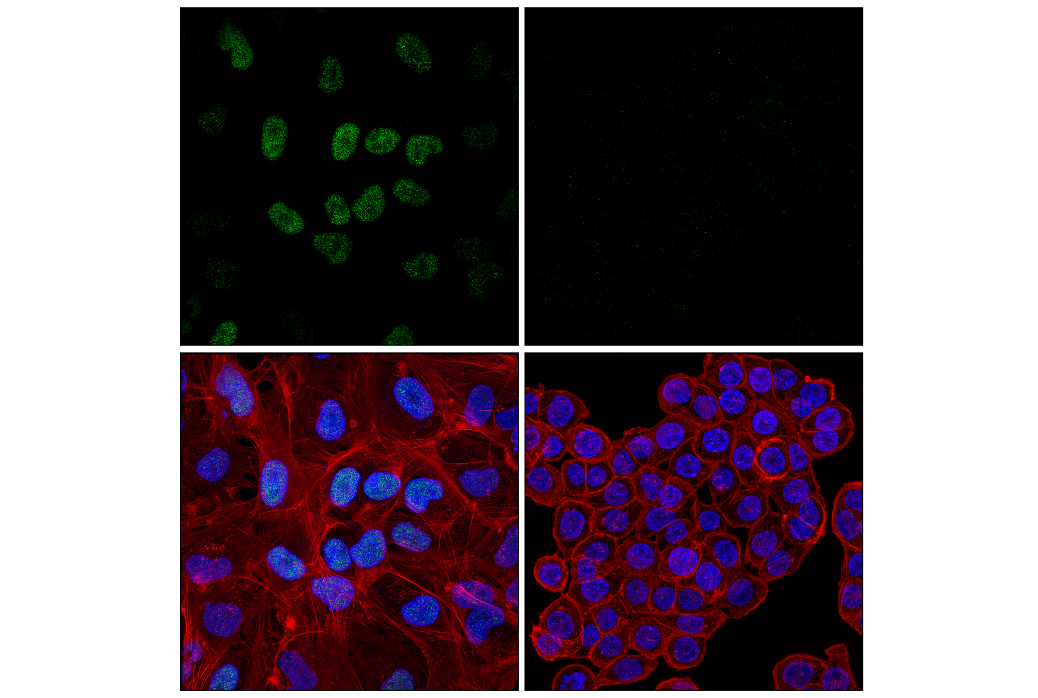 Immunofluorescence Image 1: BORIS (F6R3W) Rabbit mAb