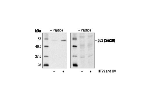 Image 1: Phospho-p53 (Ser20) Blocking Peptide