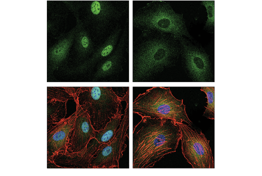 Immunofluorescence Image 1: HDAC7 (E7O8V) Rabbit mAb