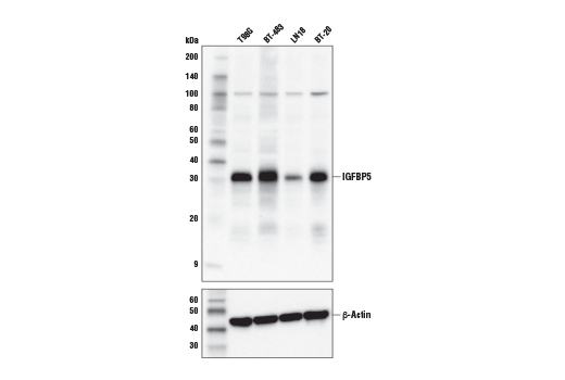 Western Blotting Image 1: IGFBP5 Antibody