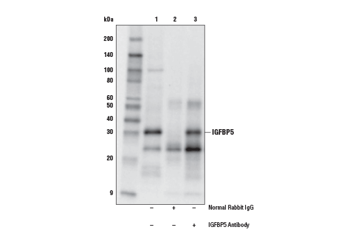 Immunoprecipitation Image 1: IGFBP5 Antibody