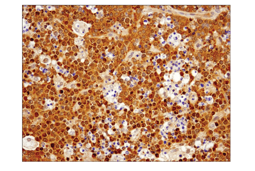 Immunohistochemistry Image 2: IRF-3 (D9J5Q) Mouse mAb