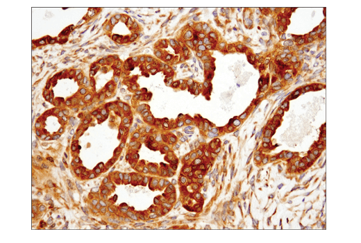 Immunohistochemistry Image 4: IRF-3 (D9J5Q) Mouse mAb