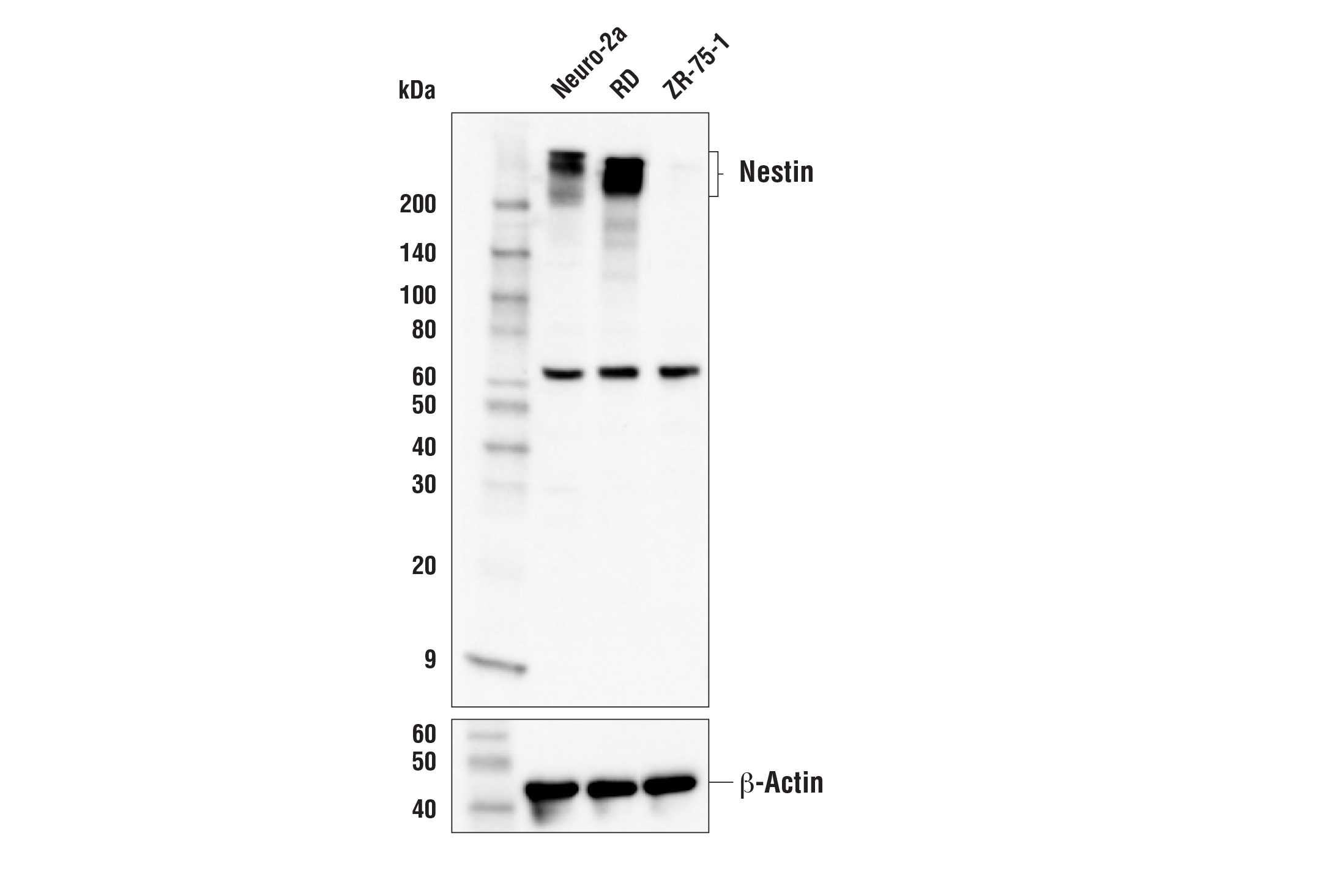 Nestin Antibody Cell Signaling Technology