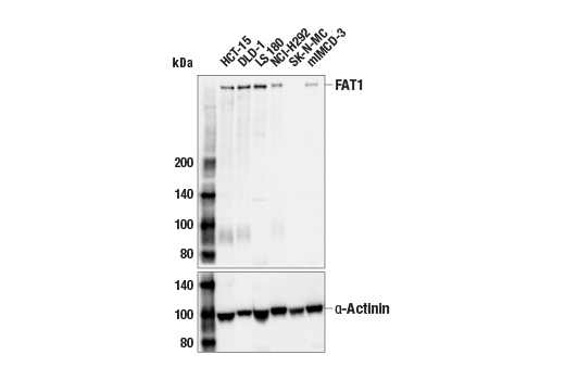 Western Blotting Image 1: FAT1 Antibody