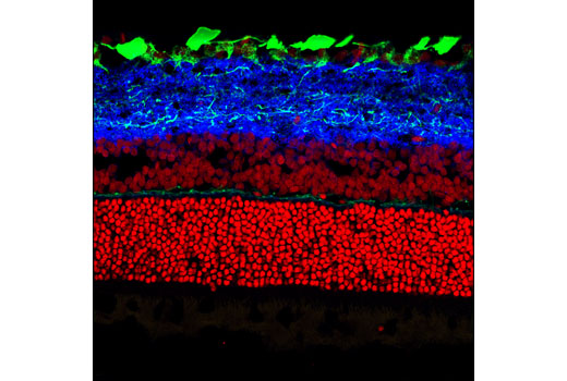 Immunofluorescence Image 1: Synapsin-1 (D12G5) XP® Rabbit mAb (Alexa Fluor® 647 Conjugate)
