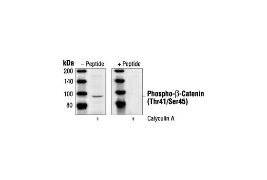  Image 1: Phospho-β-Catenin (Thr41/Ser45) Blocking Peptide