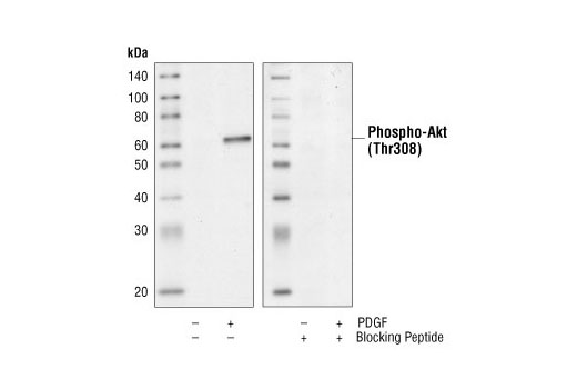  Image 2: Phospho-Akt (Thr308) Blocking Peptide