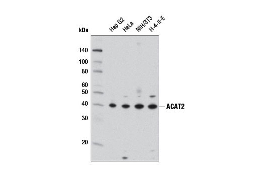 Western Blotting Image 1: ACAT2 Antibody