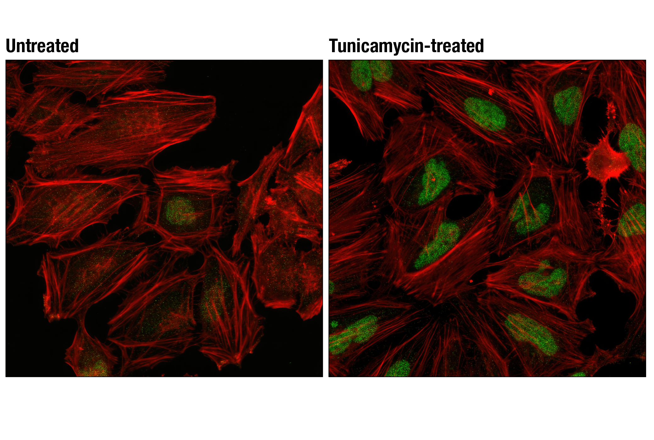 Immunofluorescence Image 1: ATF-4 (D4B8) Rabbit mAb