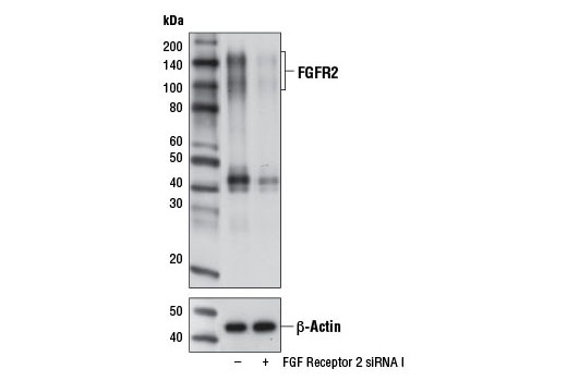 Western Blotting Image 2: FGF Receptor 2 (D4H9) Rabbit mAb