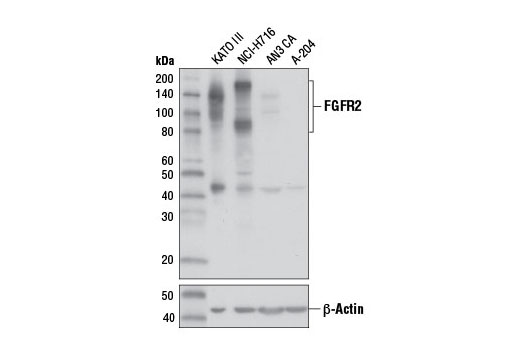 Western Blotting Image 3: FGF Receptor 2 (D4H9) Rabbit mAb