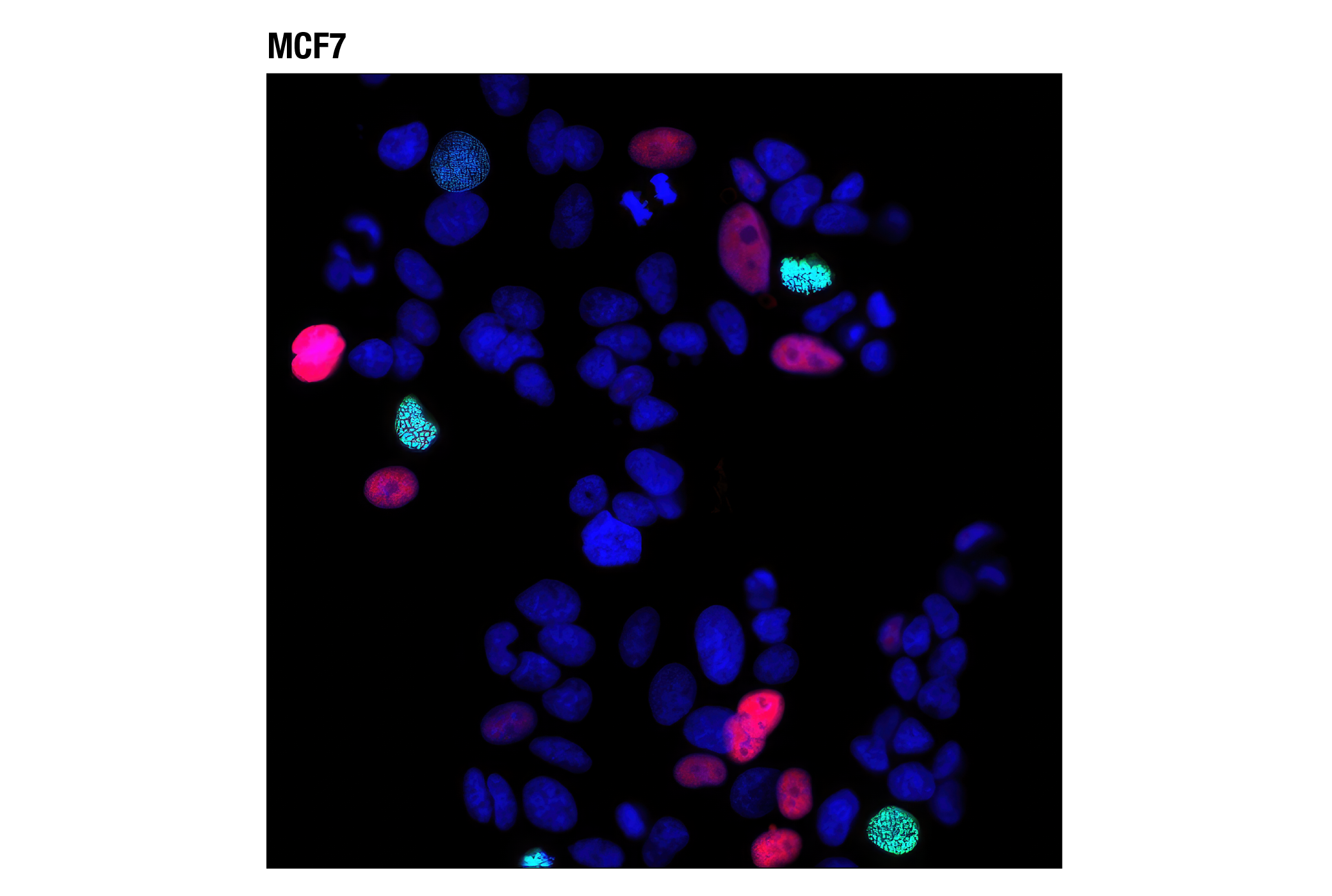 Immunofluorescence Image 1: p21 Waf1/Cip1 (12D1) Rabbit mAb (Alexa Fluor® 594 Conjugate)